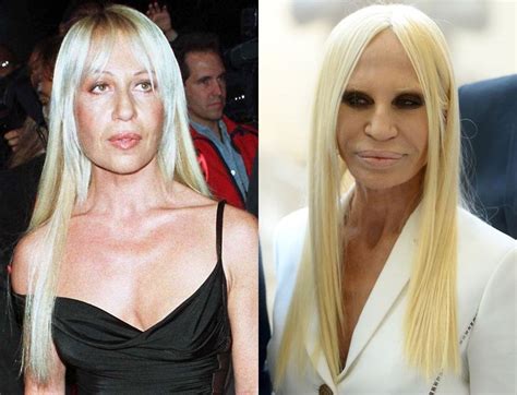 donatella versace before plastic surgery|Young Donatella Versace: The Evolution Of Donatella.